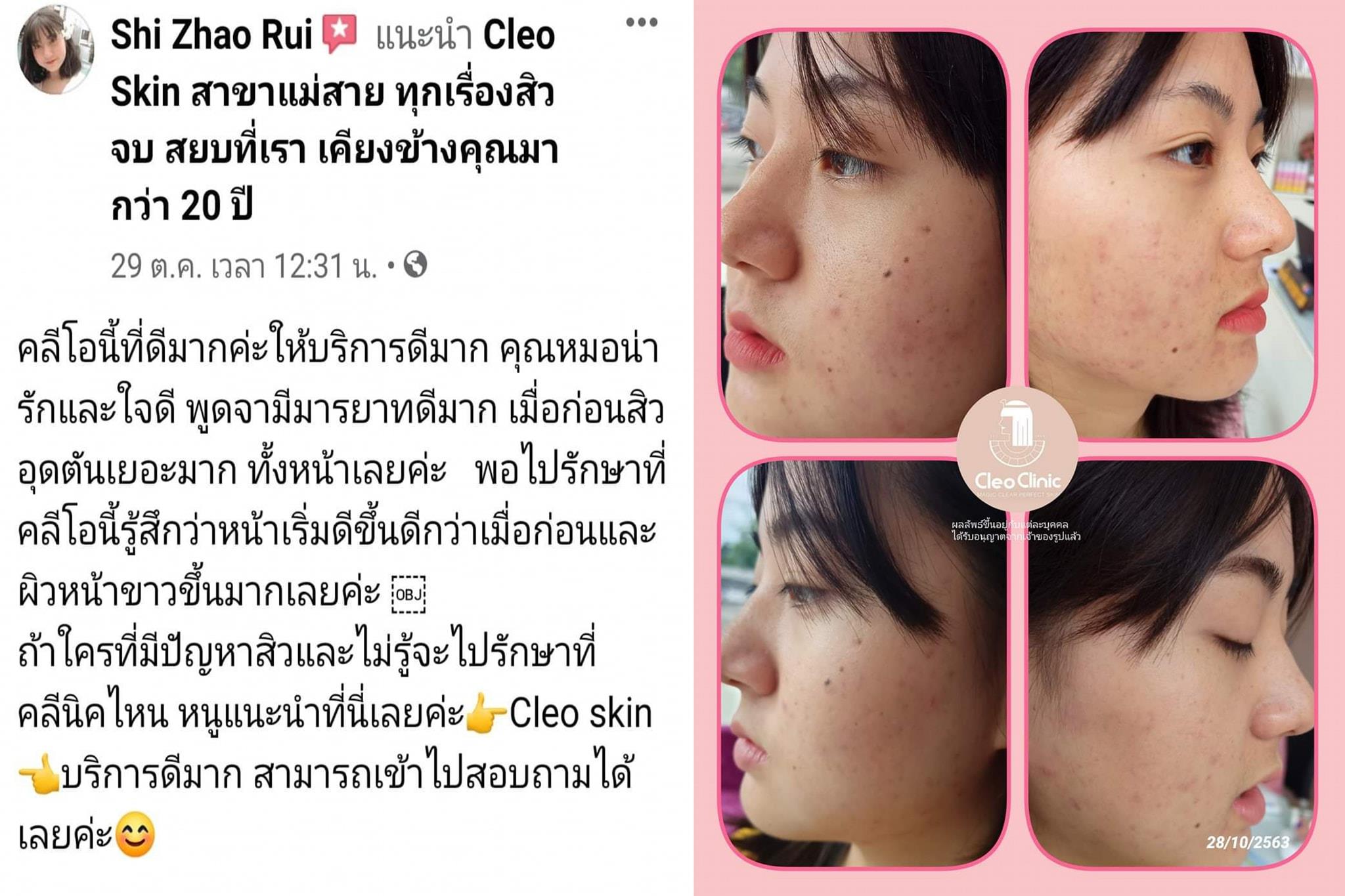 รีวิว ปี 62