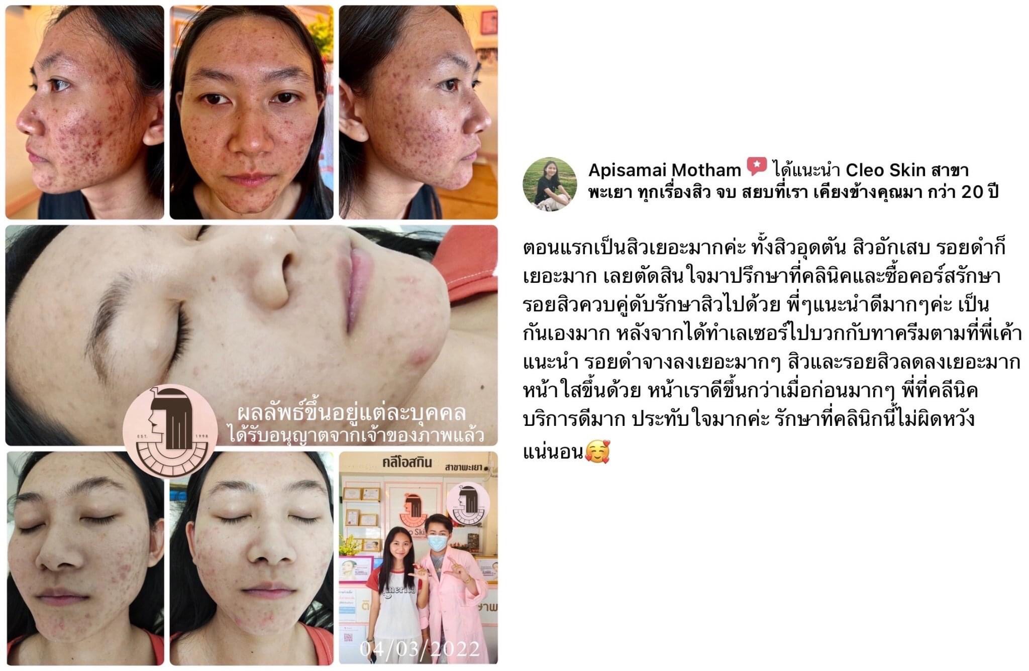 รีวิว ปี 62