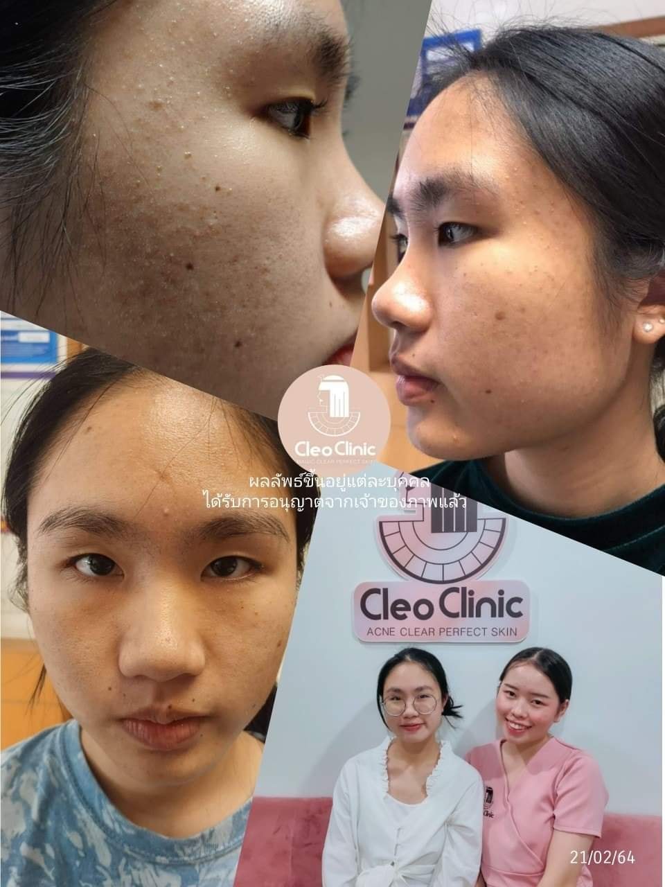 รีวิว ปี 62