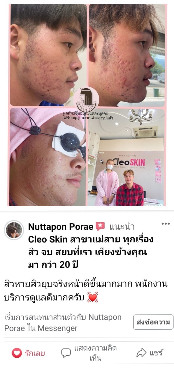 รีวิว ปี 62