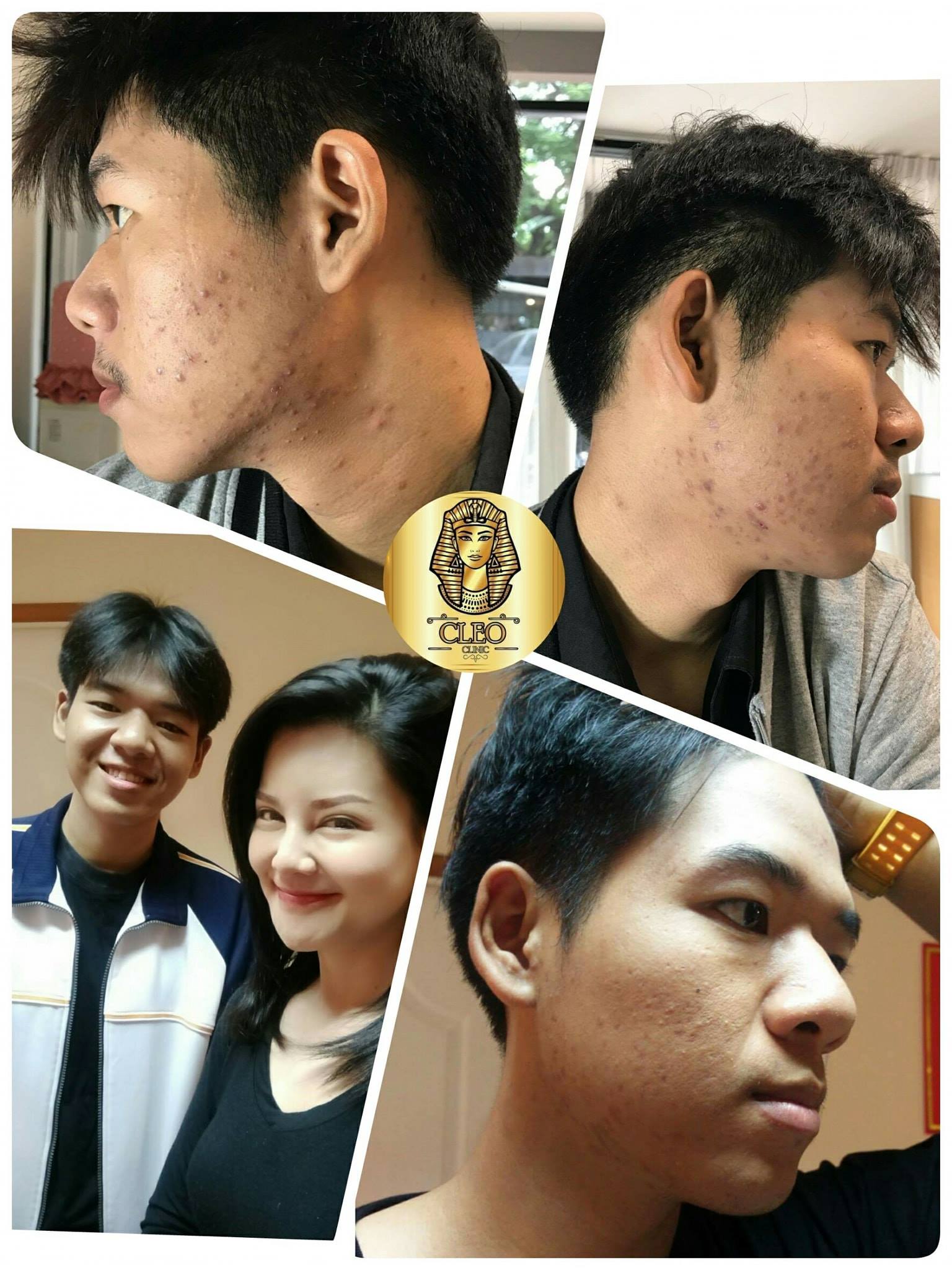 รีวิว ปี 62