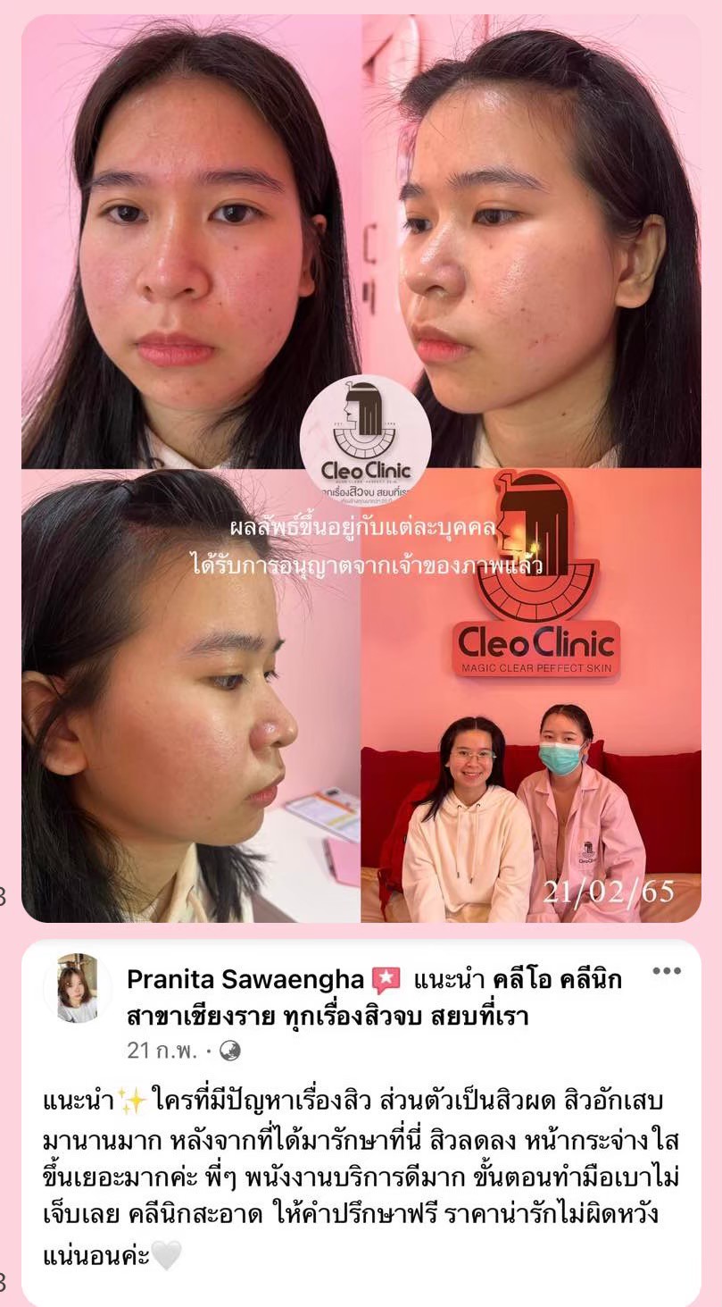 รีวิว ปี 62