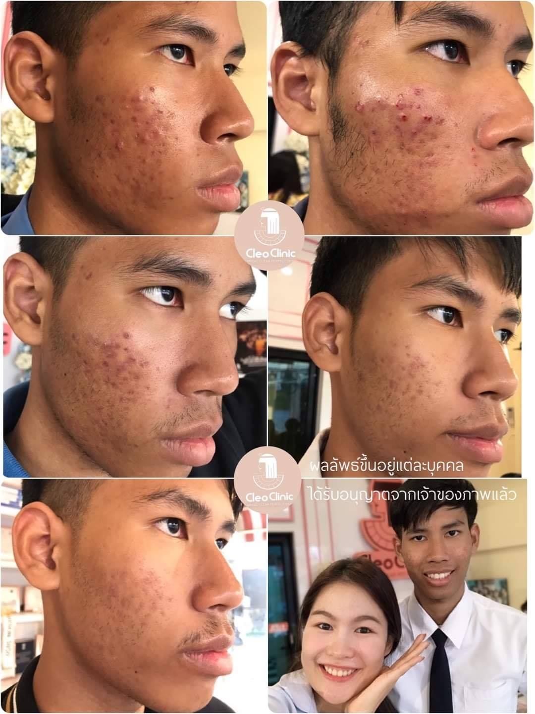 รีวิว ปี 62