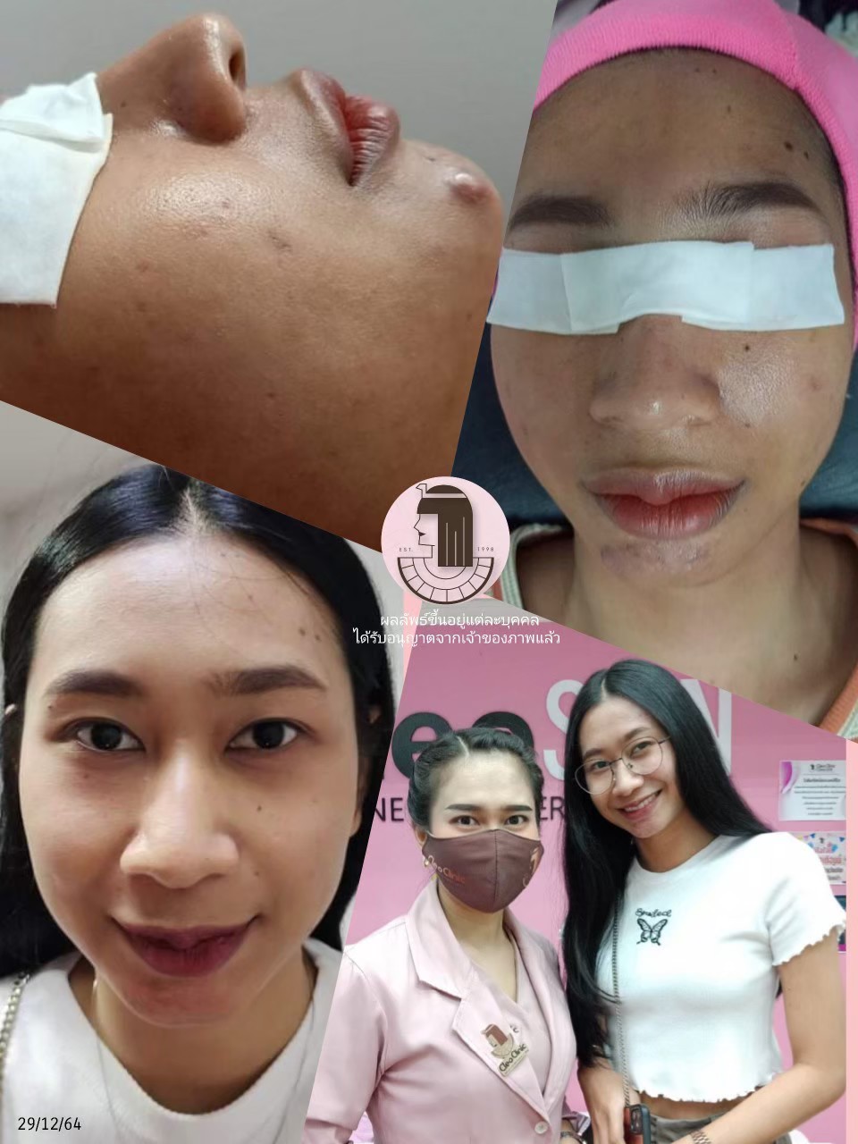 รีวิว ปี 62