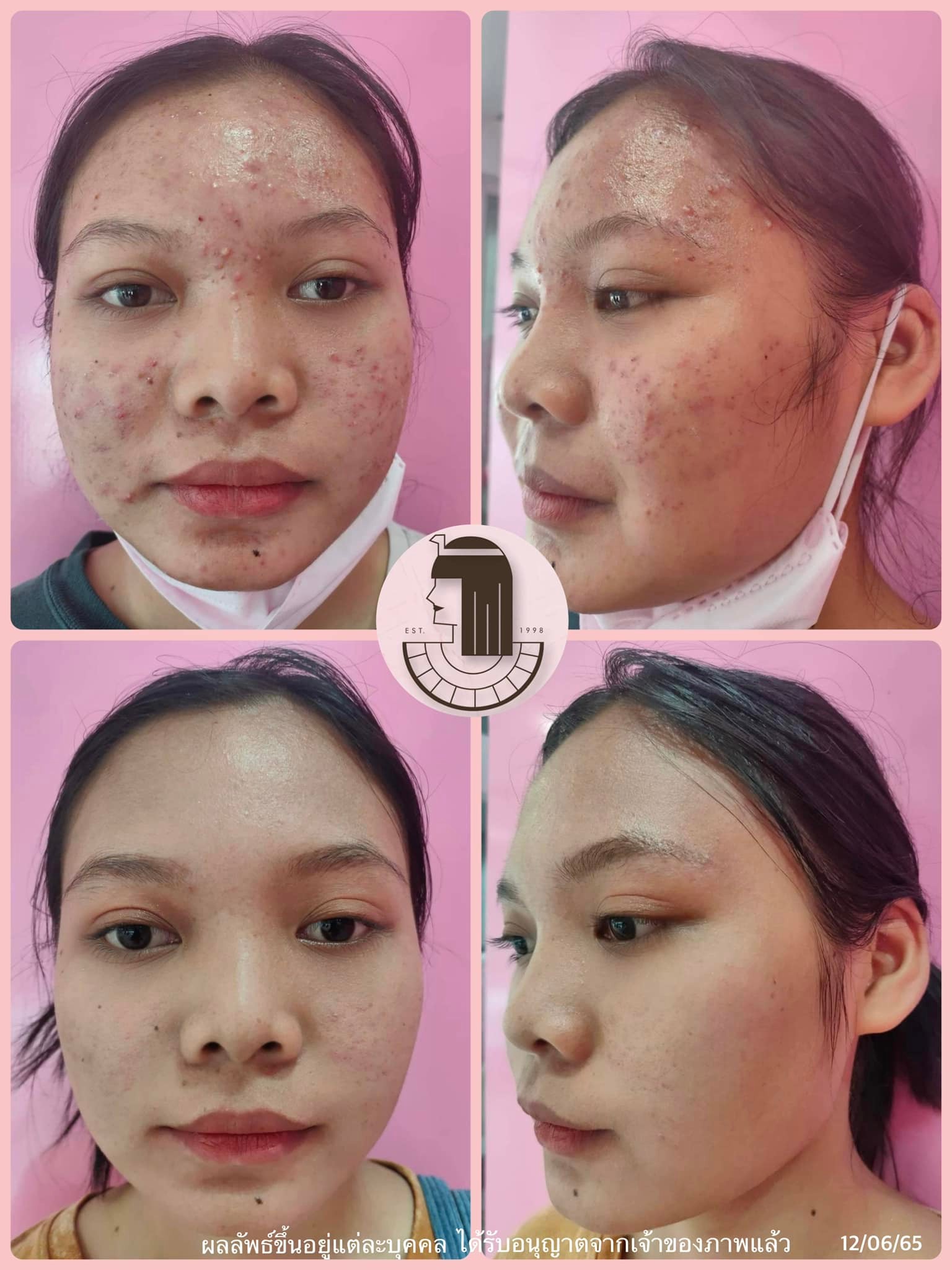 รีวิว ปี 62