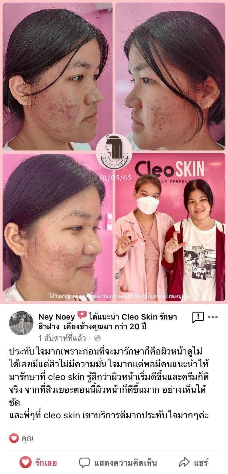 รีวิว ปี 62