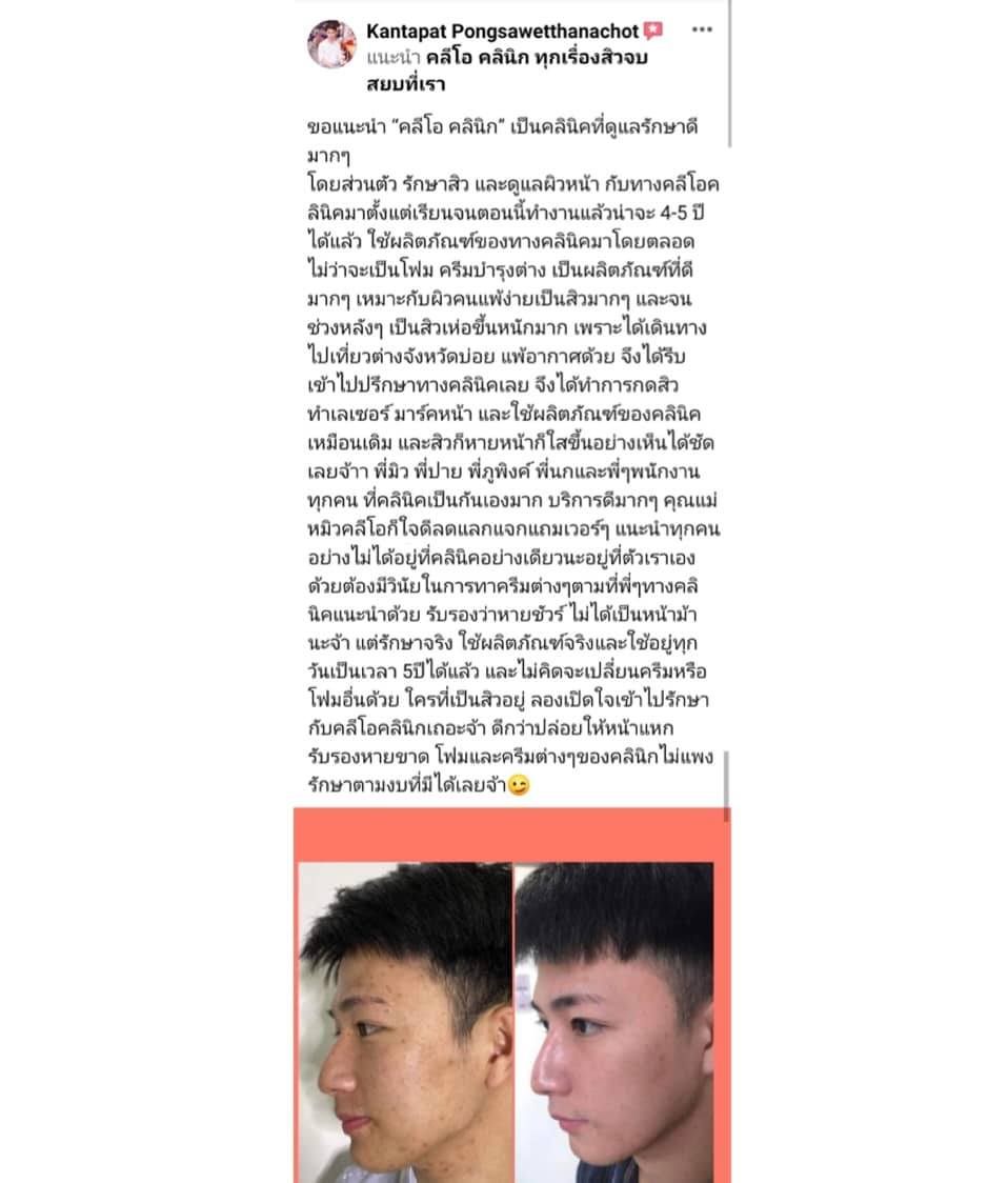 รีวิว ปี 62