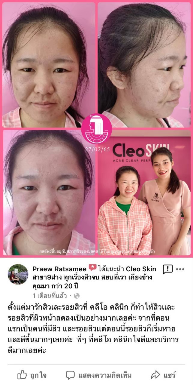 รีวิว ปี 62