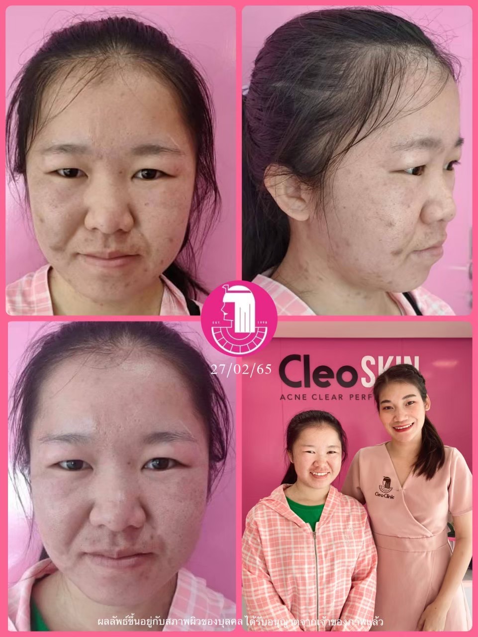 รีวิว ปี 62