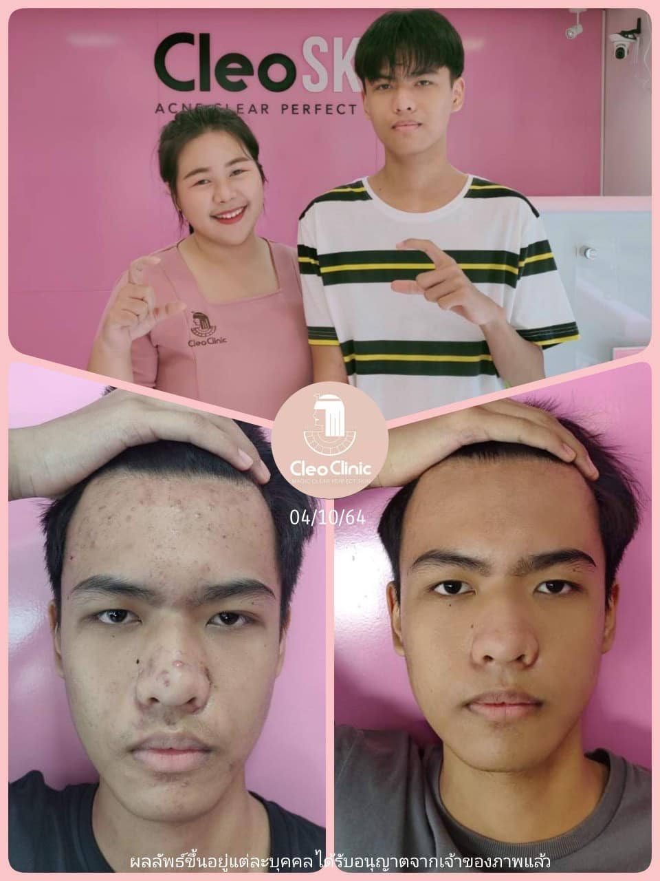 รีวิว ปี 62