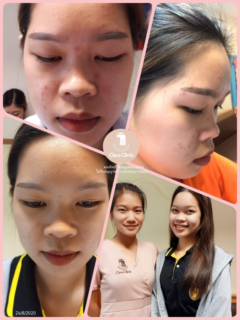 รีวิว ปี 62