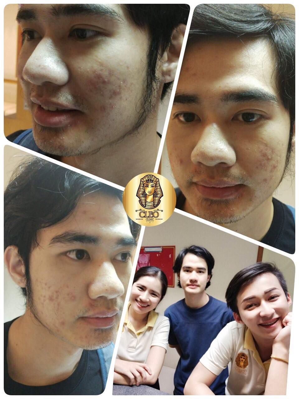 รีวิว ปี 62