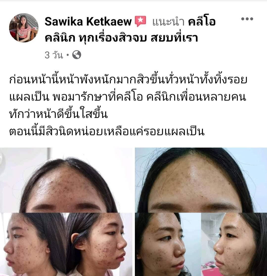 รีวิว ปี 62