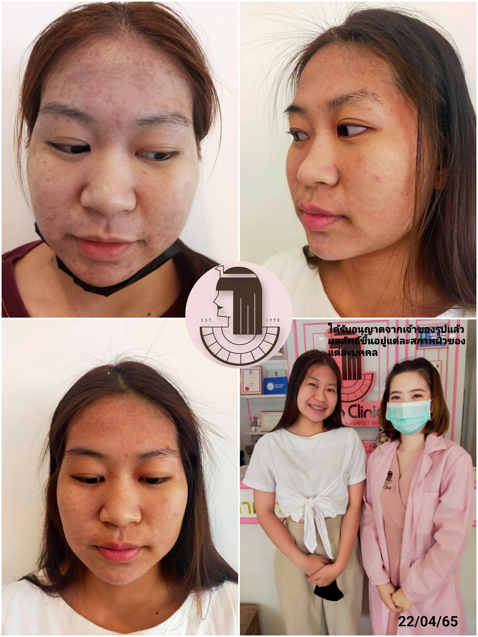 รีวิว ปี 62