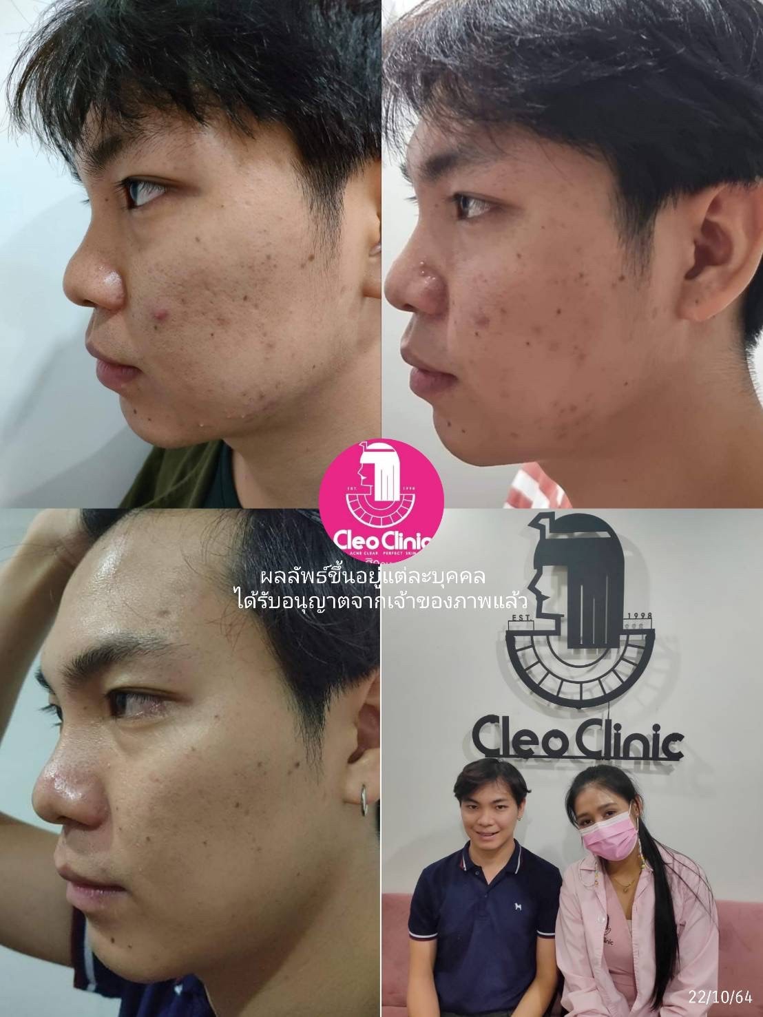 รีวิว ปี 62