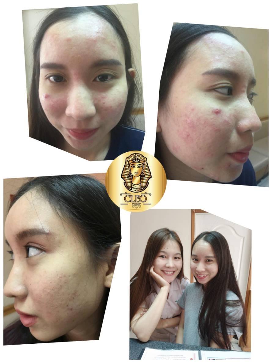 รีวิว ปี 62