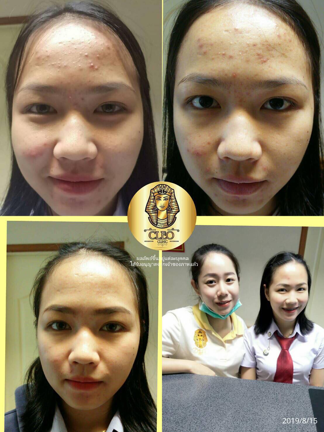 รีวิว ปี 62