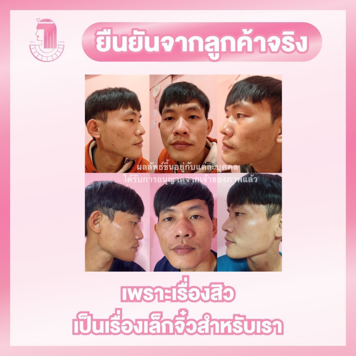 รีวิว ปี 62