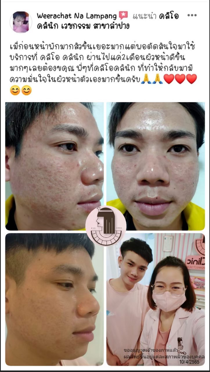 รีวิว ปี 62