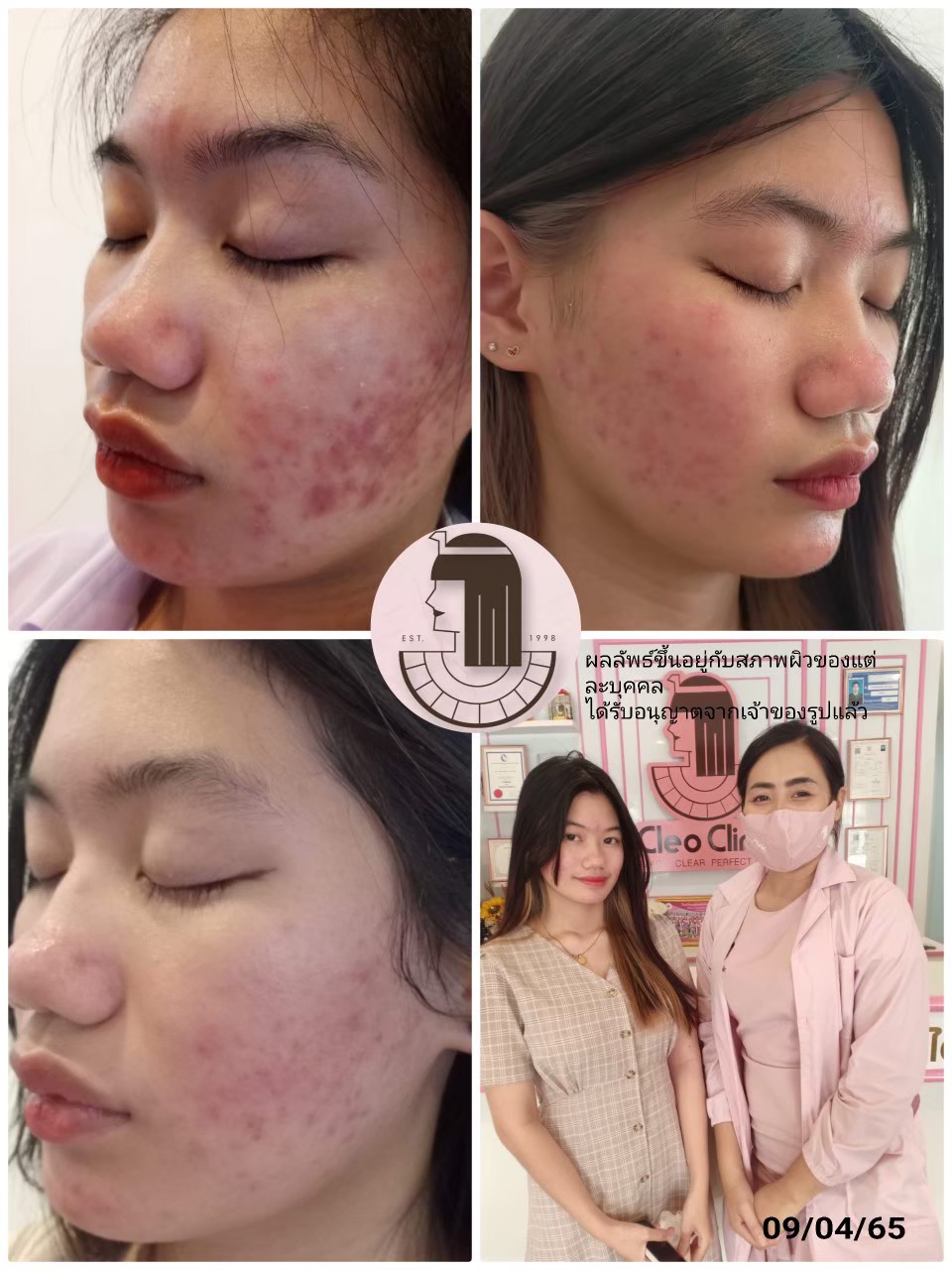 รีวิว ปี 62