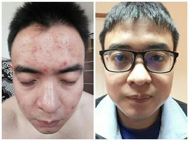 รีวิว ปี 62