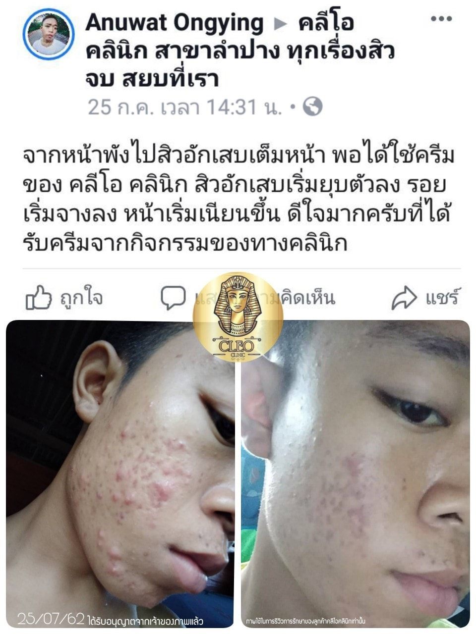 รีวิว ปี 62