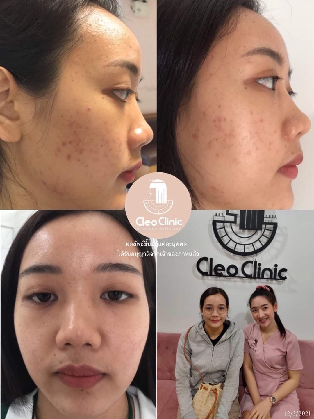 รีวิว ปี 62