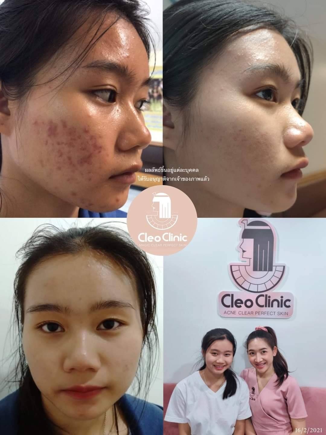 รีวิว ปี 62