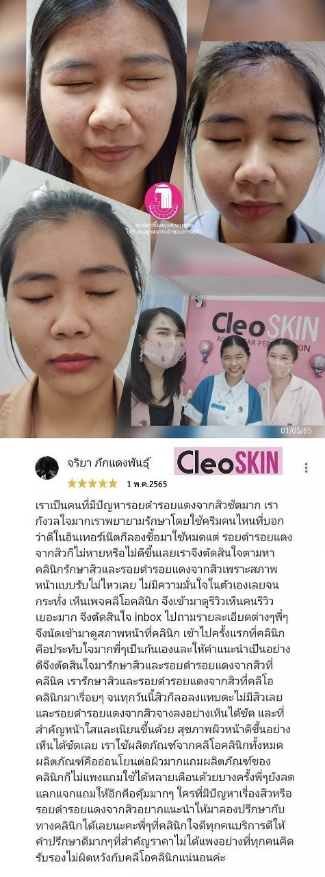 รีวิว ปี 62