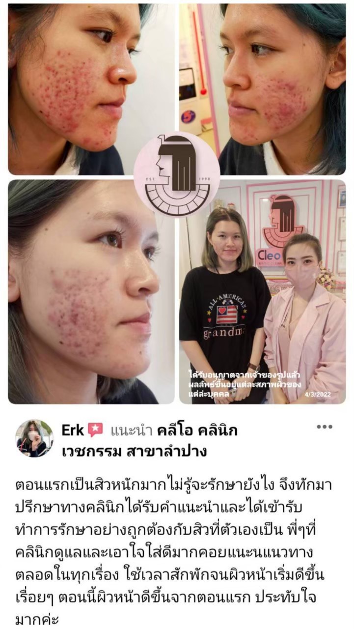 รีวิว ปี 62