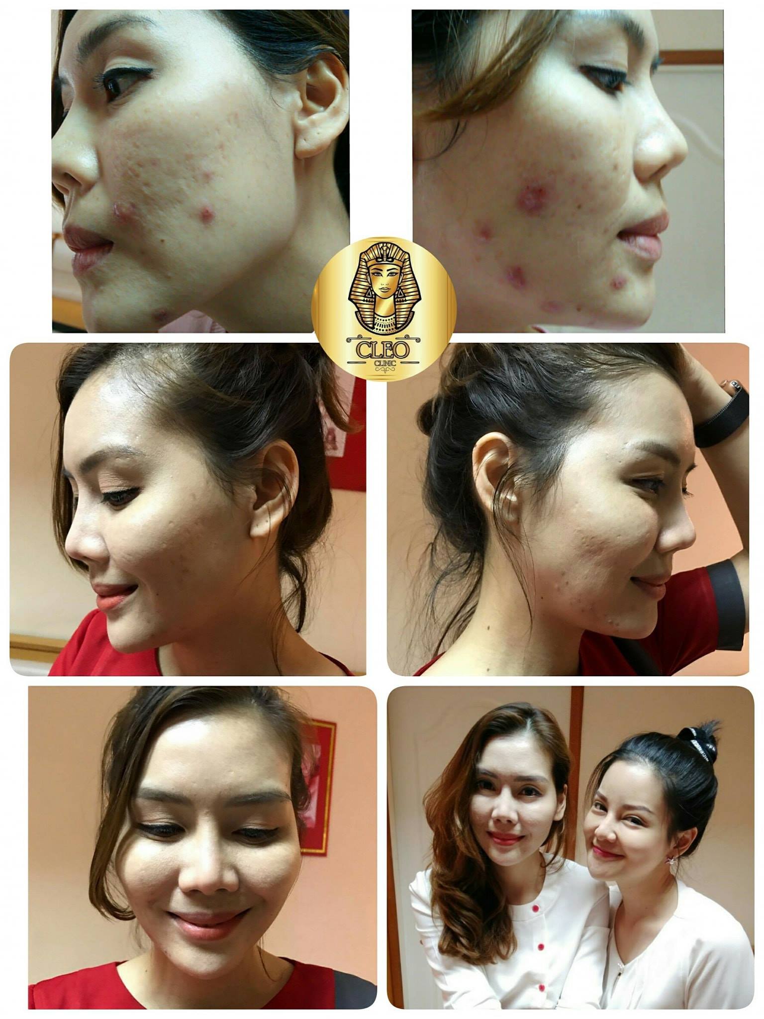 รีวิว ปี 62