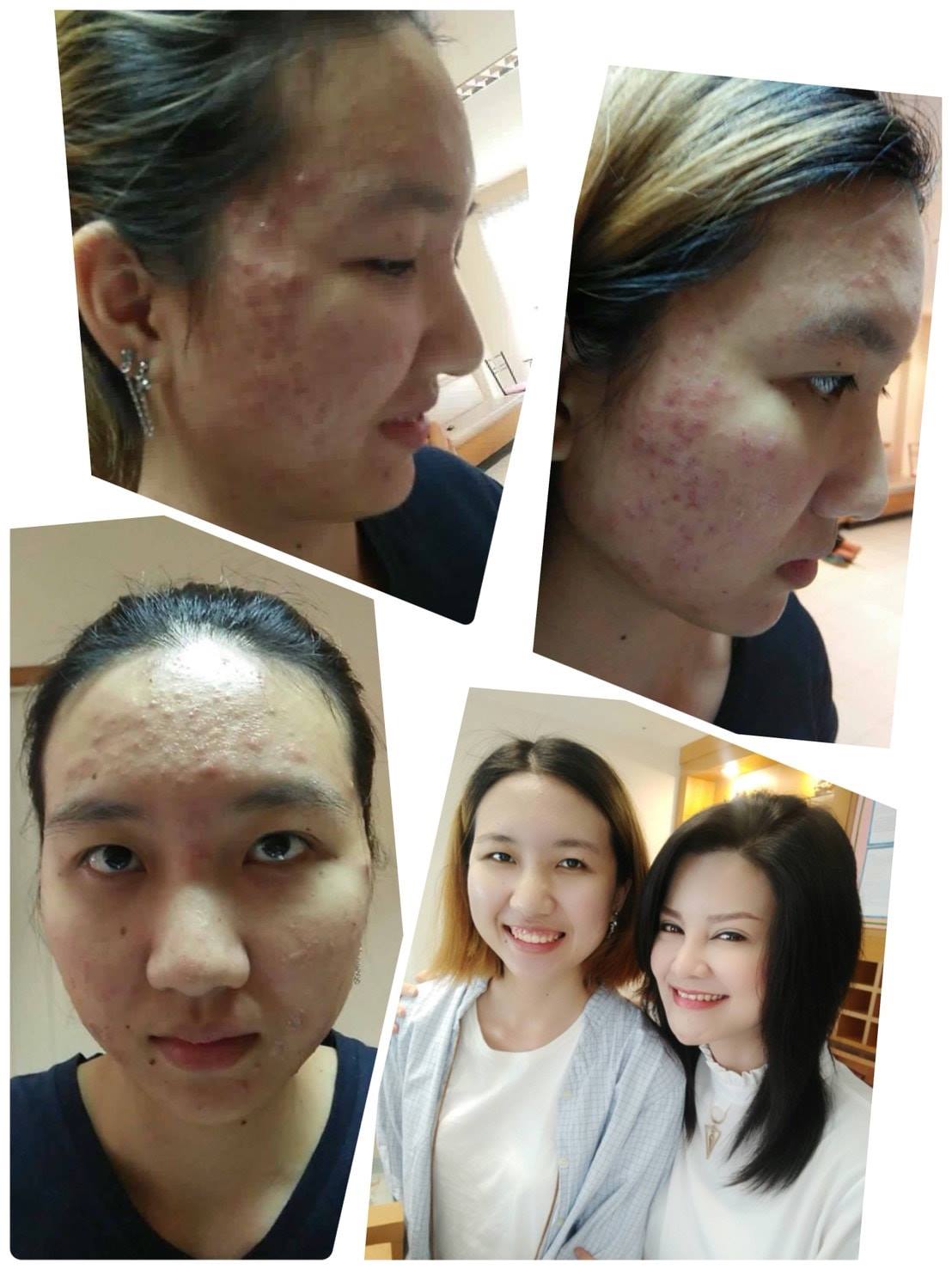 รีวิว ปี 62