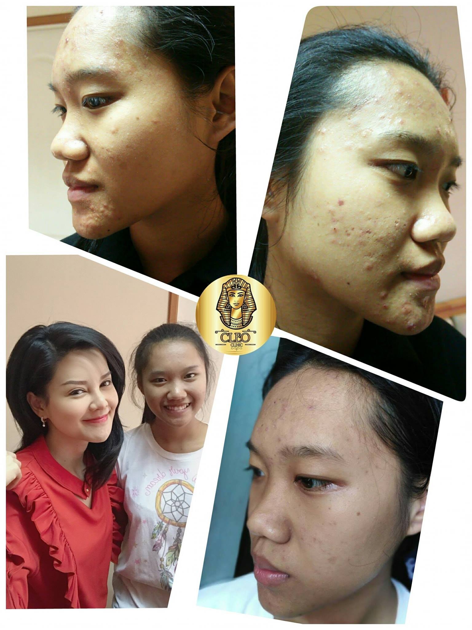 รีวิว ปี 62