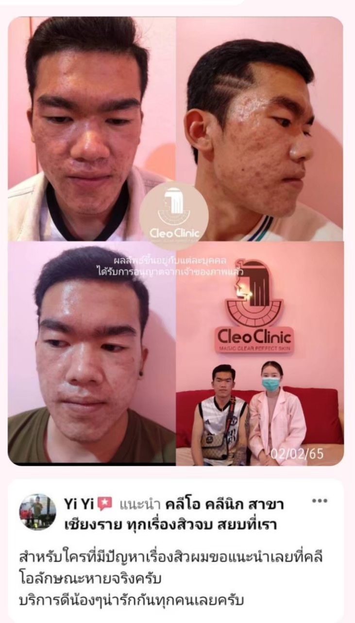 รีวิว ปี 62