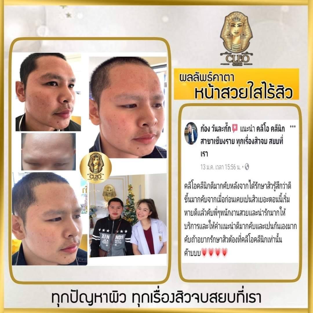 รีวิว ปี 62