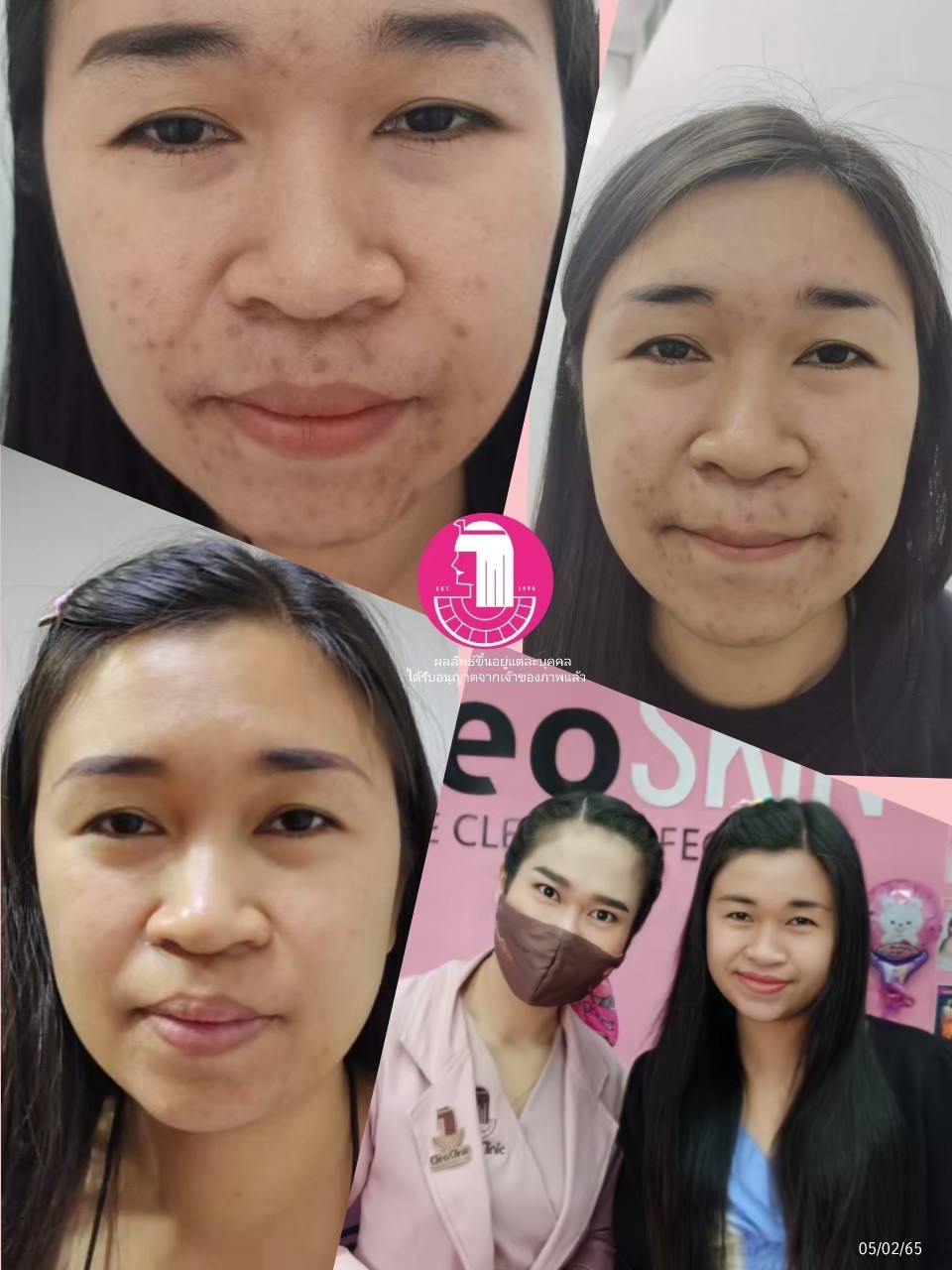 รีวิว ปี 62