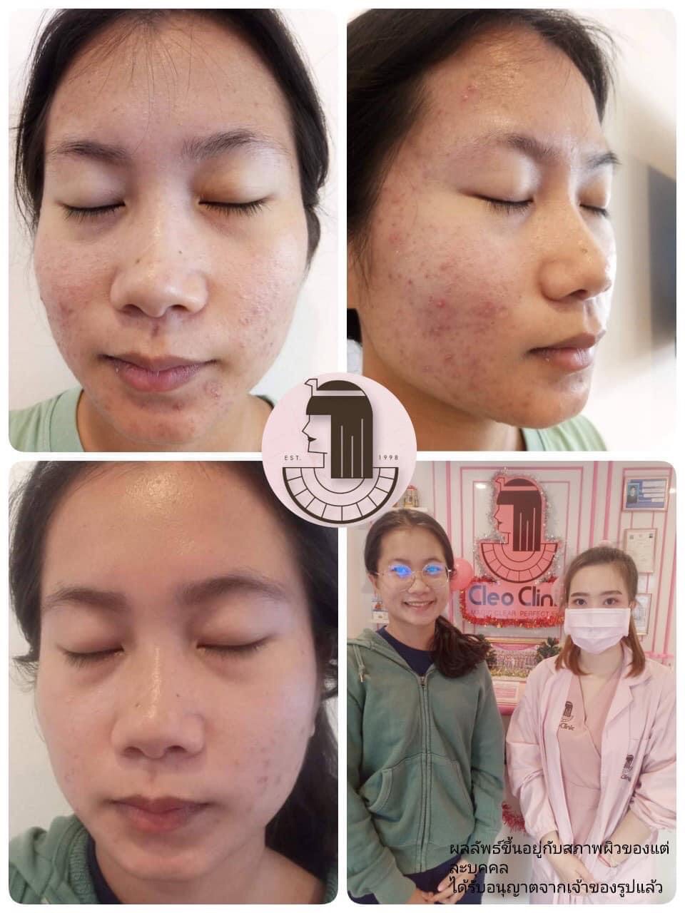 รีวิว ปี 62