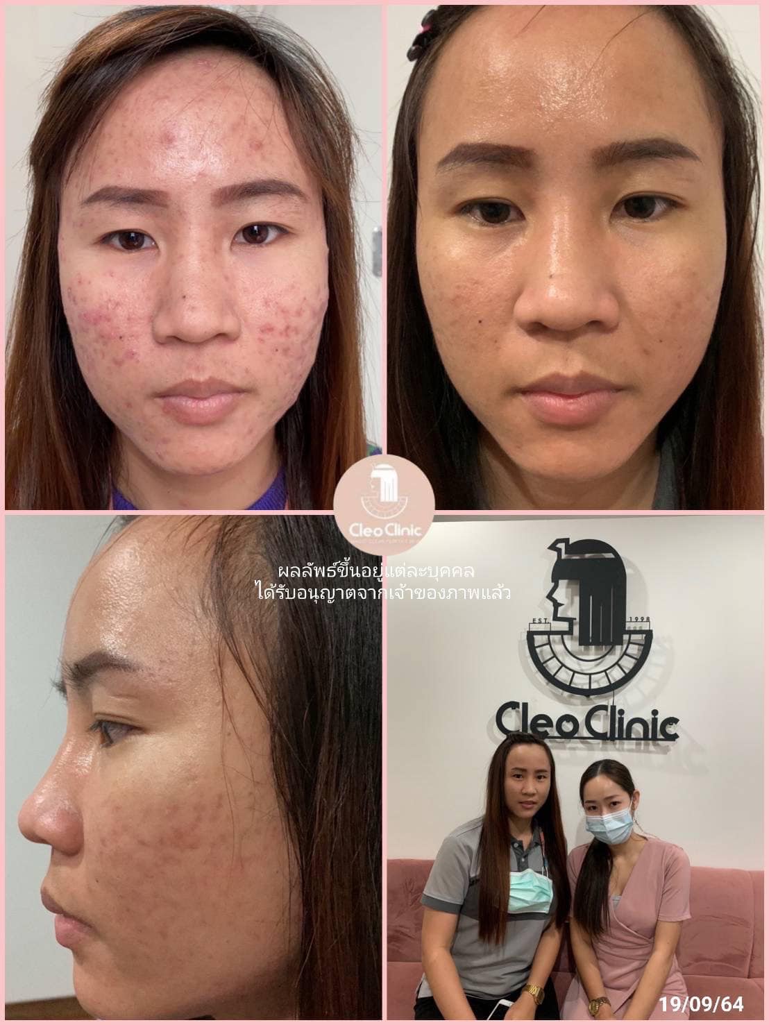 รีวิว ปี 62