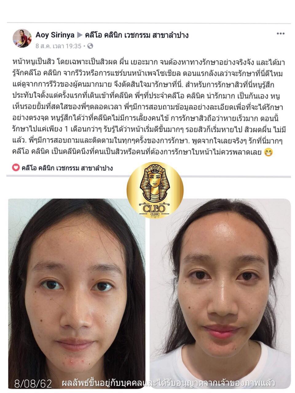 รีวิว ปี 62