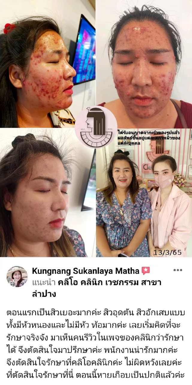 รีวิว ปี 62