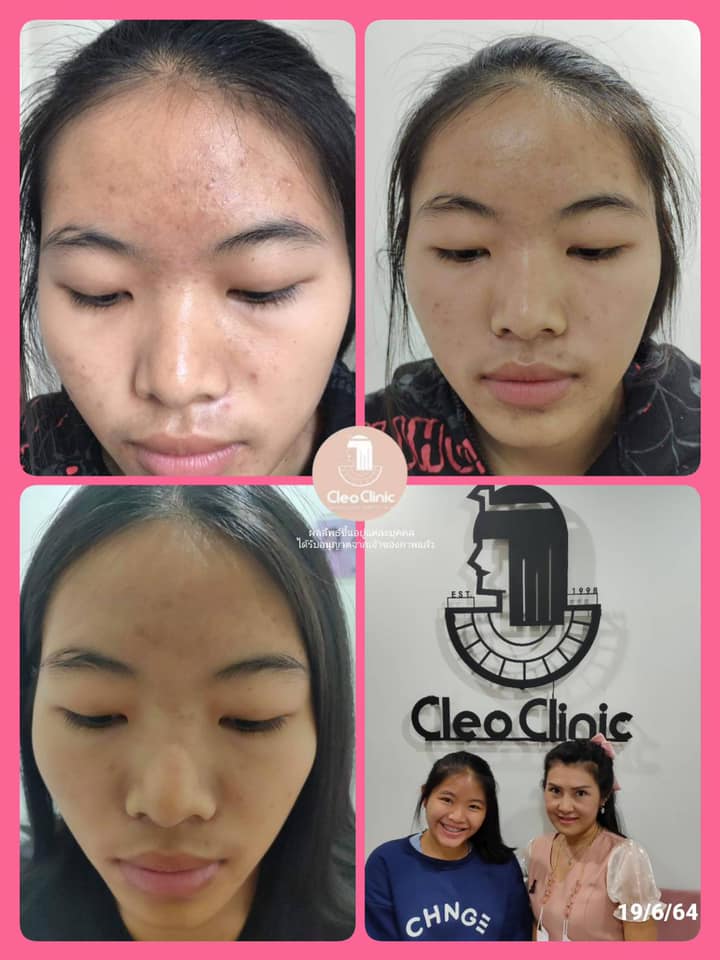 รีวิว ปี 62