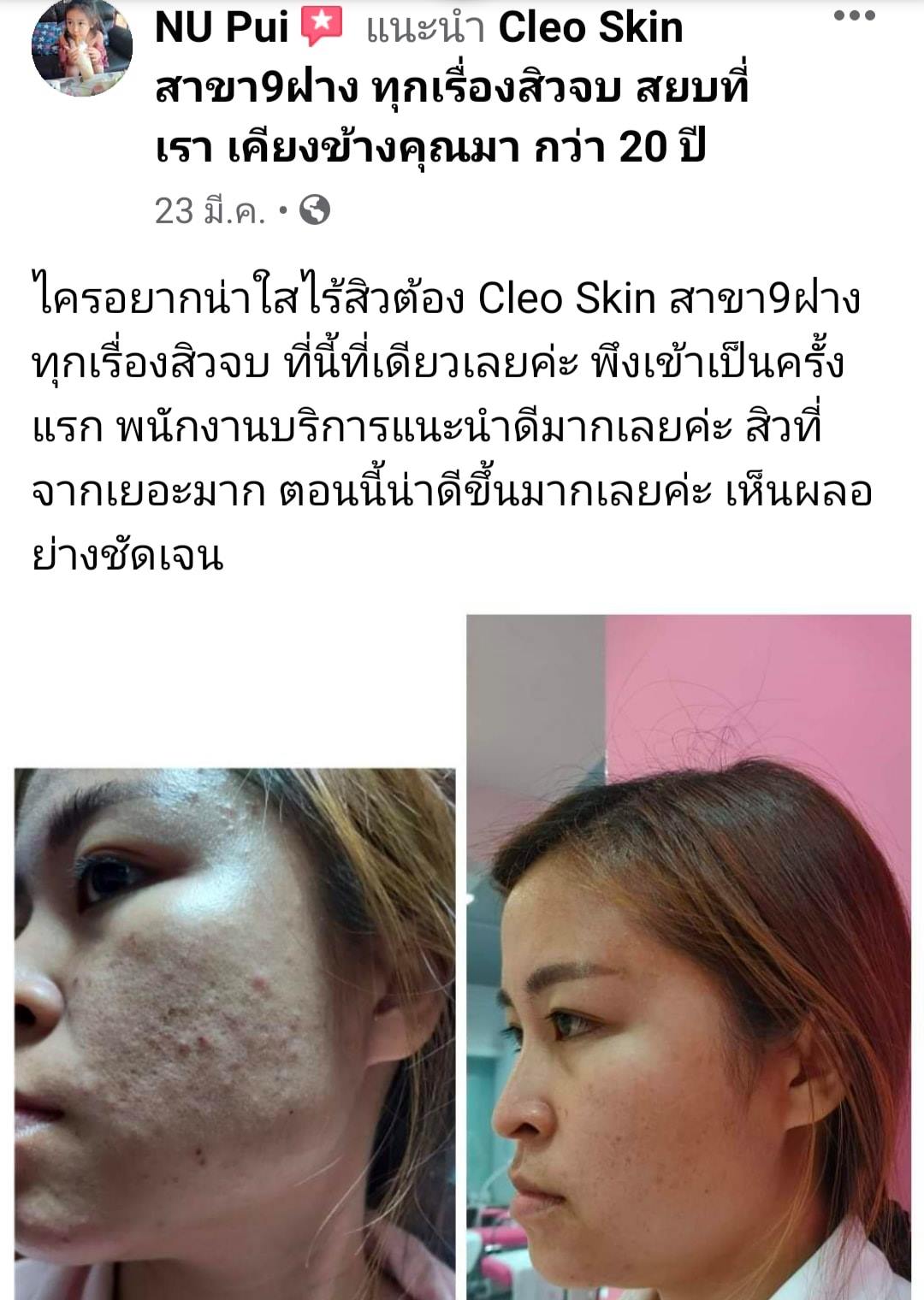 รีวิว ปี 62