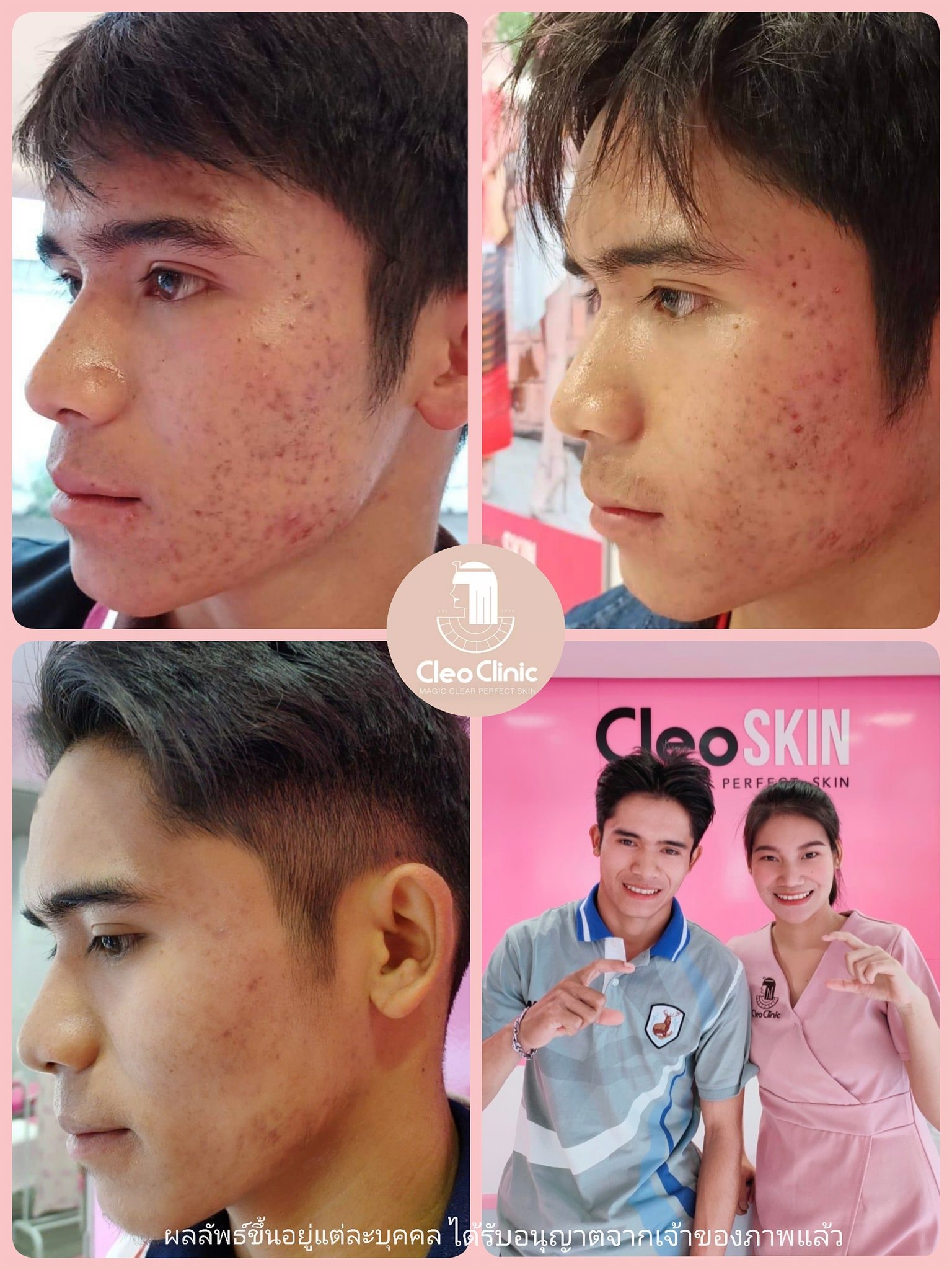 รีวิว ปี 62