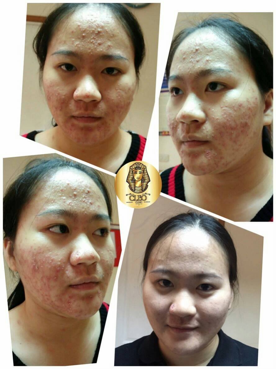 รีวิว ปี 62