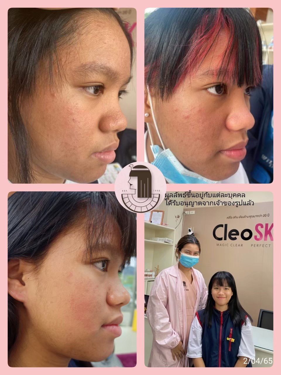 รีวิว ปี 62