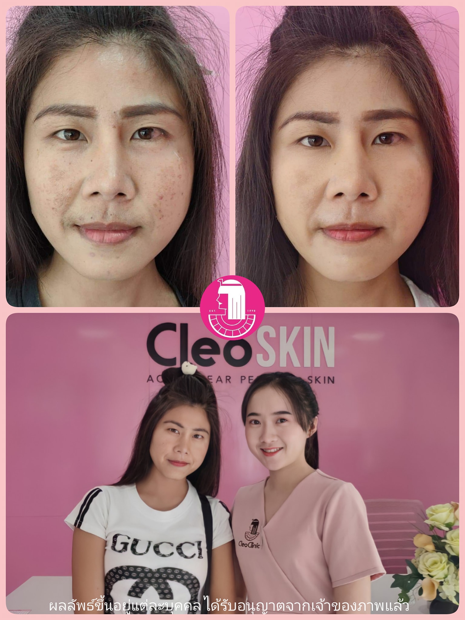 รีวิว ปี 62