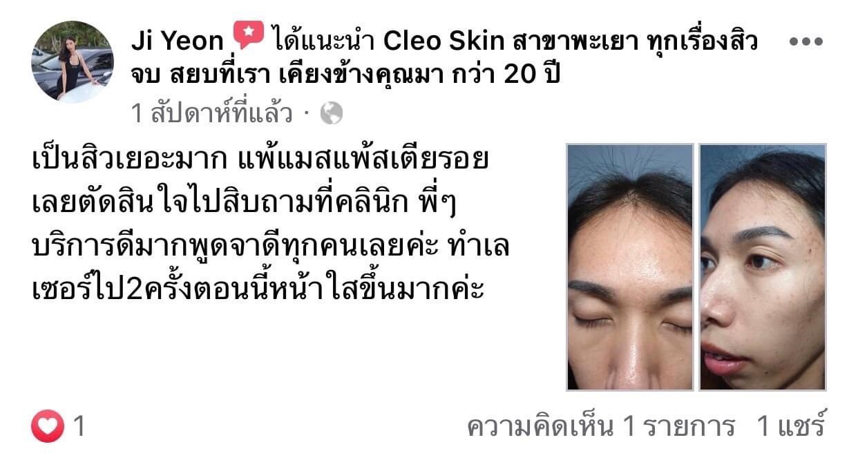 รีวิว ปี 62