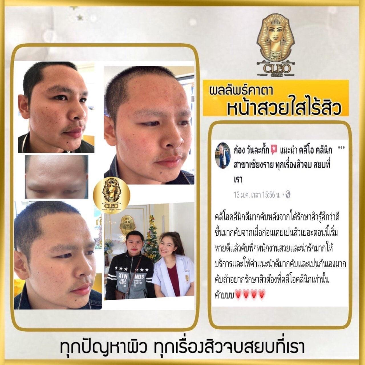 รีวิว ปี 62