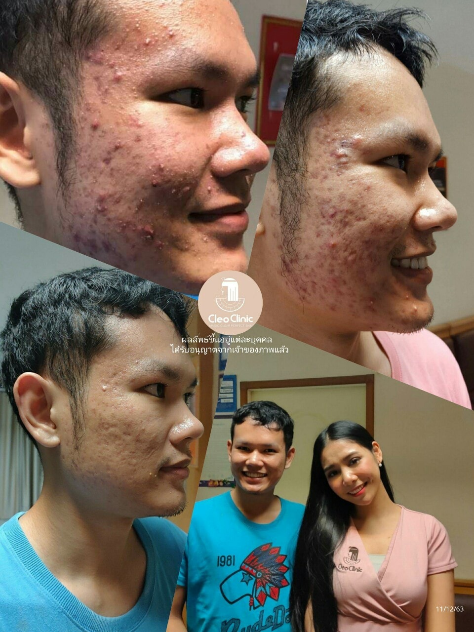 รีวิว ปี 62