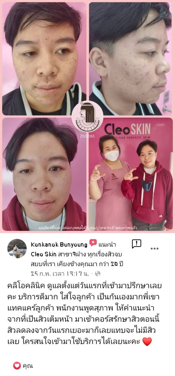 รีวิว ปี 62